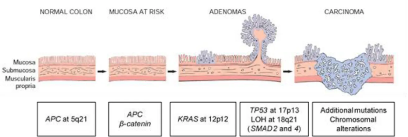 Figure 1.1 - The adenoma-carcinoma sequence. Main histological and molecular changes. (Adapted from: Kumar et al