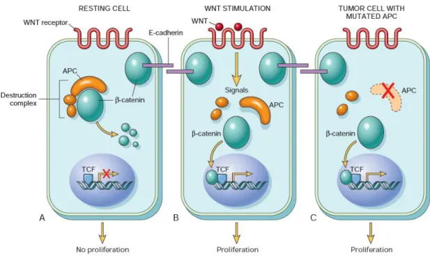 Figure  1.2  -  Schematic  overview  of  the  WNT  signaling  pathway  and  its  role  in  colorectal  cancer