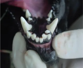 Figura 18 - Apinhamento dentário (Lobprise, 2012b)