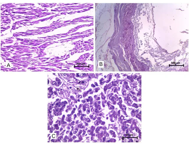 Figura  1  –  Imagens  histológicas  de baços  coletados  após  o  primeiro descongelamento,  onde  se  observa:  A)  Grupo  1,  com  manutenção  das  estruturas  foliculares  linfoides  (autólise  discreta);  B)  Grupo  2,  com  separação  das  camadas  e