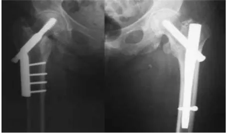 Figura 4 – Imagem radiográfica comparativa dos dois tipos de procedimentos 