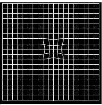 Figura 5 – Figura mostrando simulação de possível percepção de metamorfopsia central. 