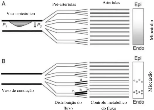 Figura  11  -  Diferenças  entre  a  isquémia  miocárdica  causada  por  estenose  coronária  significativa  (A)  e  por  disfunção  microvascular  coronária  (B)