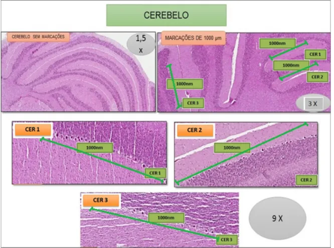 Figura 9 – Imagem histológica com a metodologia empregada para a seleção das áreas do cerebelo