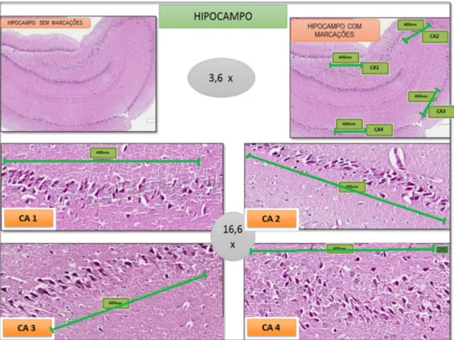 Figura 10 – Imagens histológicas com a metodologia empregada para a seleção das áreas do hipocampo