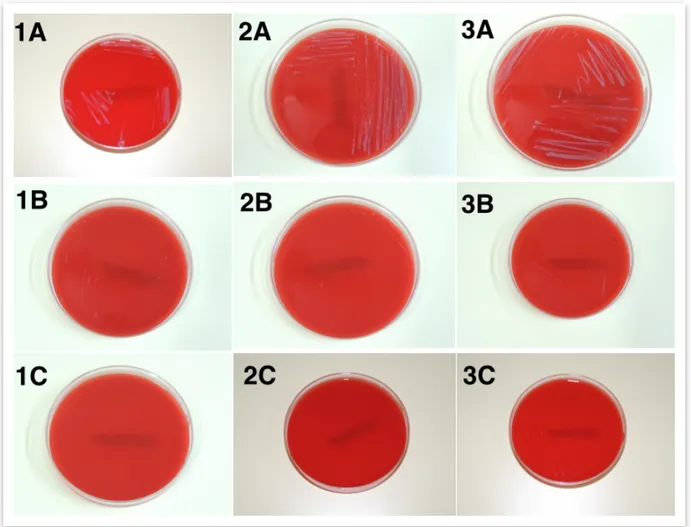 Figura 04 – Placas de Petri de todas as amostras, após terceira fase do experimento 