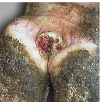 Figura 9 – Lesão típica de dermatite digital  (retirado de www.progressivedairy.com).
