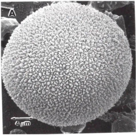 Fig.  9  -  Microfotografia  de  microscópio  electrónico  de  varrimento  de  um  teratócito  de  Microplitis  sp.,  cinco  dias  após  a  sua  formação  (Dahlman &amp; Vinson 1993)