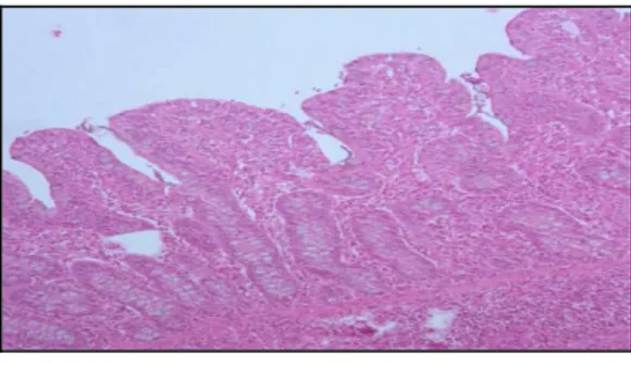 Ilustração 4. Corte histológico (objectiva 10x) da mucosa intestinal. 