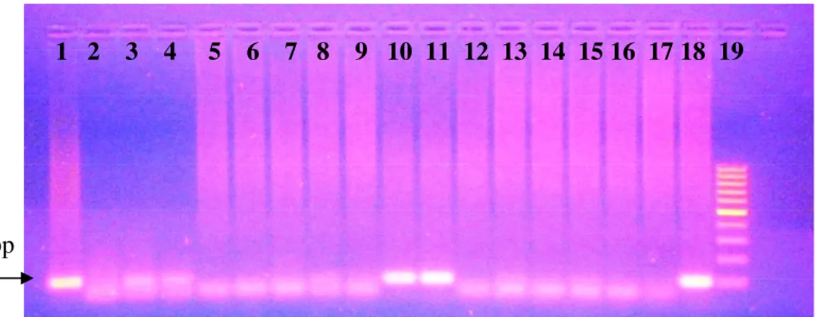 Figura 7. Resultados da detecção da amplificação do gene B1, por electroforese em gel  de  agarose  (1,5%)