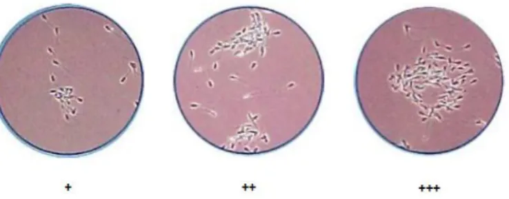 Figura  6  -  Observação  ao  microscópio  dos  diferentes  graus  de  aglutinação  dos  espermatozoides (adaptado de Le Coz, 2006) 