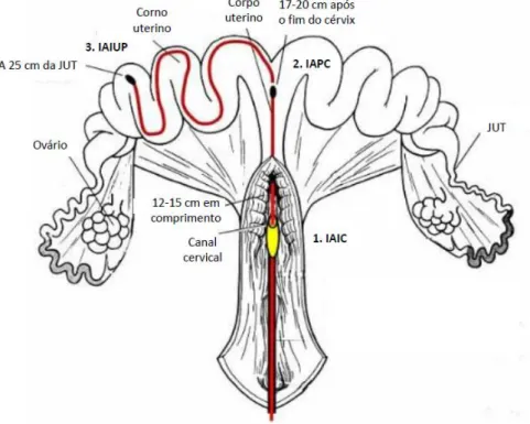 Figura 9 - Locais de deposição de sémen na inseminação  intra-cervical  (IAIC), inseminação  artificial pós-cervical (IAPC) e inseminação artificial intrauterina profunda (IAIUP) (adaptado  de Belstra, 2002)