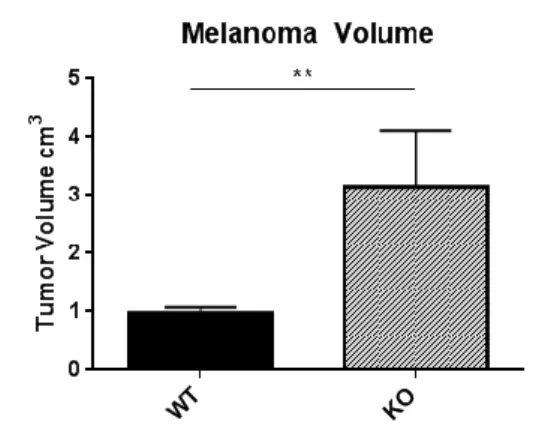 Figure 5: Tumor volume in wild-type and LDLR knockout mice: Melanoma Model. Tumor volume (cm 3 ) was determined by caliper  measurements of length and width after 14 days of tumor development
