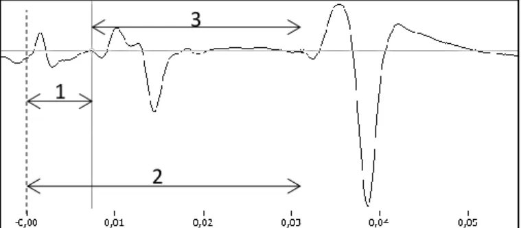 Figure  2. Representative  example  of  the  soleus  M  wave  and  H  reflex.  Legend:  dashed  line  –  onset  stimulus;  gray  line  –  M-wave  beginning;  black  line  –  H-reflex  beginning;  1-  M-wave  latency; 2- H-reflex latency; 3- latency differe