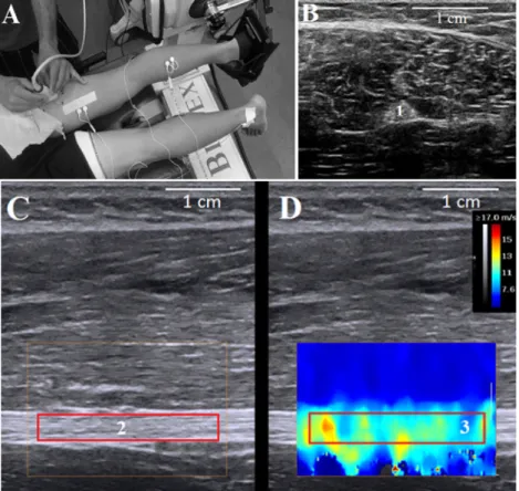 Figure  6.  (A)  Testing  setup.  B-mode  sonograms  of  the  sciatic  nerve  in  (B)  cross-sectional  and  (C)  longitudinal  views