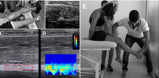 Figure 9. A – Experimental setup; B – Cross-sectional view of the sciatic nerve (1) in B-mode; C –  Longitudinal  view  of  the  sciatic  nerve  in  B-mode;  D  –  Elastogram  window  was  defined  above  the  nerve section, and the largest area within the
