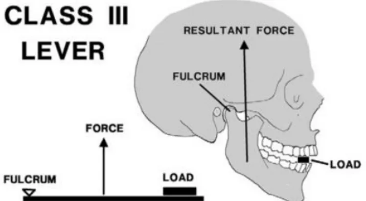 Figure 2. Illustration suggesting that the mandible functions as a class III lever. Image retrieved  from Ellis et al