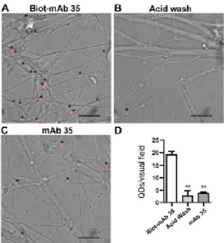 Figure 2.1 - Images showing the number  of QDs (A) when using Biot-mAb 35 (0.1 mg/