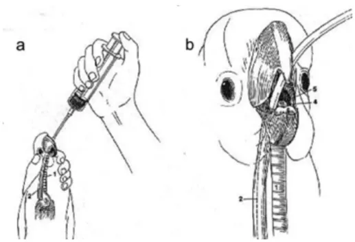 Figure 3: Tube-feeding. The bird is held in an upright position with the neck extended (a) and the tube  passed through the left side of the oral cavity down to the oesophagus and into the right side of the 