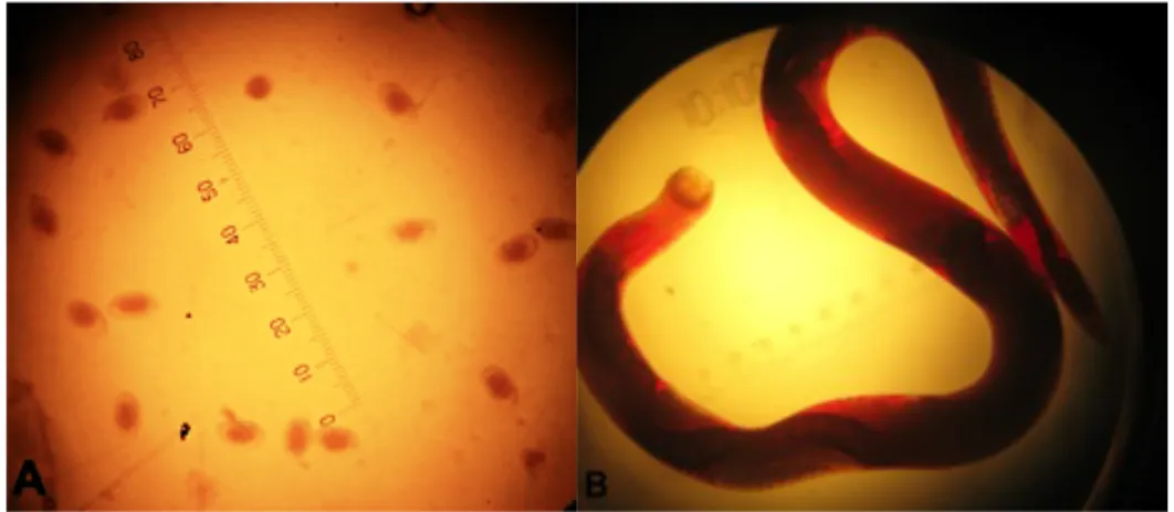 Figure 7: A) Nematode eggs after fecal wet mount under microscope magnification (x40); B)  Syngamus trachea worm under optical microscope magnification (x10) 