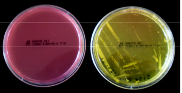 Figura 18 – Placas de Petri com o Agar de Sal de Manitol, antes e após fermentação 