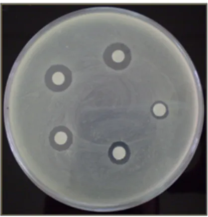 Figura 3 – Exemplo de inibição de crescimento bacteriano em torno dos discos de papel 