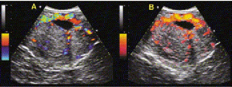 Fig 3- Images of 2 CL from a 48-day pregnant mare shown in colour-flow mode (A) and power- power-flow mode (B) from similar sections