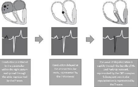 Fig 2 - Diagram representation of the cardiac conduction system and the relationship between the  spread of conduction and the surface ECG (Adapted from: van Loon &amp; Patterson, 2010)   