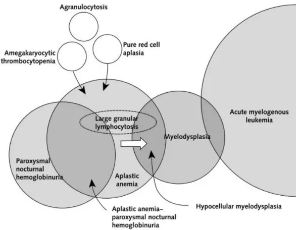 Figura 3. Diagrama representativo da sobreposição de características clínicas e fisiopatológicas da anemia  aplástica e de outras patologias hematológicas