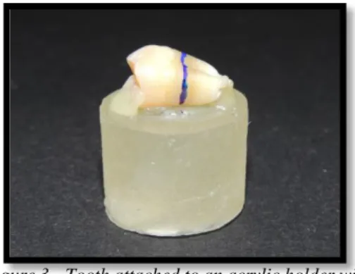 Figure 3 - Tooth attached to an acrylic holder with  sticky wax.