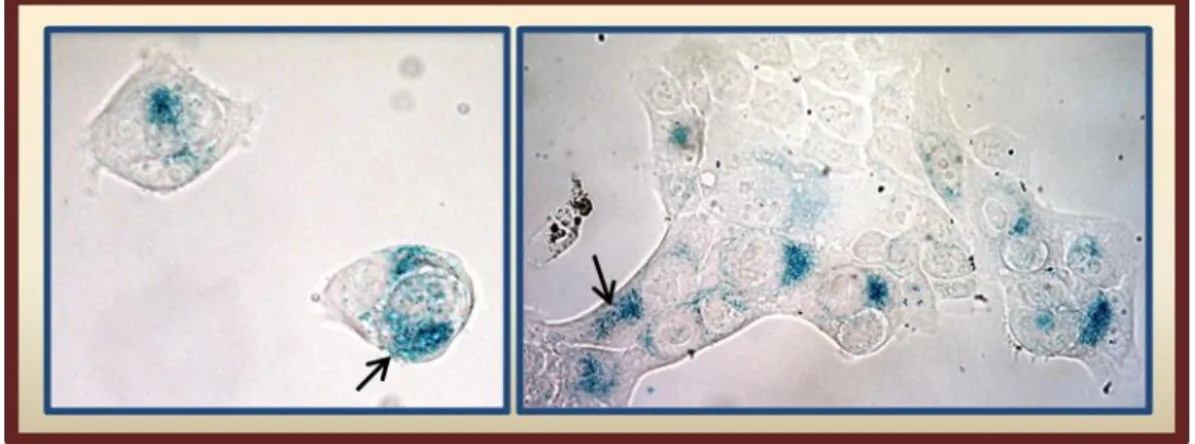 Figure 1.7- Representative images of senescent cells with distinct morphological features in vitro