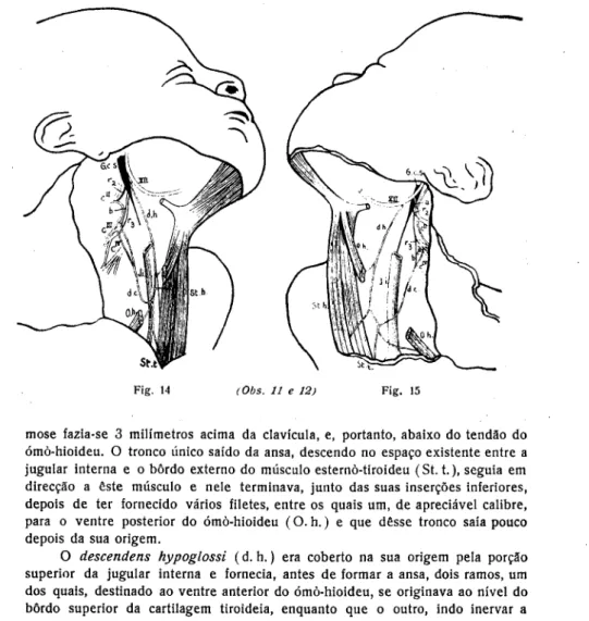 Fig. 15 — Do lado esquerdo a observação colhida constituía um dos casos,  aliás muito raros, que correspondem à descrição que encontramos na maior parte  dos tratados : a ansa do hipoglosso, disposta numa verdadeira arcada, era formada  à custa dos dois ra