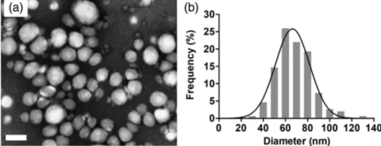 Figure 2. TEM image analysis of RA-NPs. (a) Representative TEM image of RA- RA-NPs (scale bar ¼ 100 l m)
