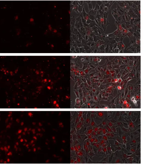 Figure 9 – Fluoresnce microscopy analysis of different transfection reagent concentrations