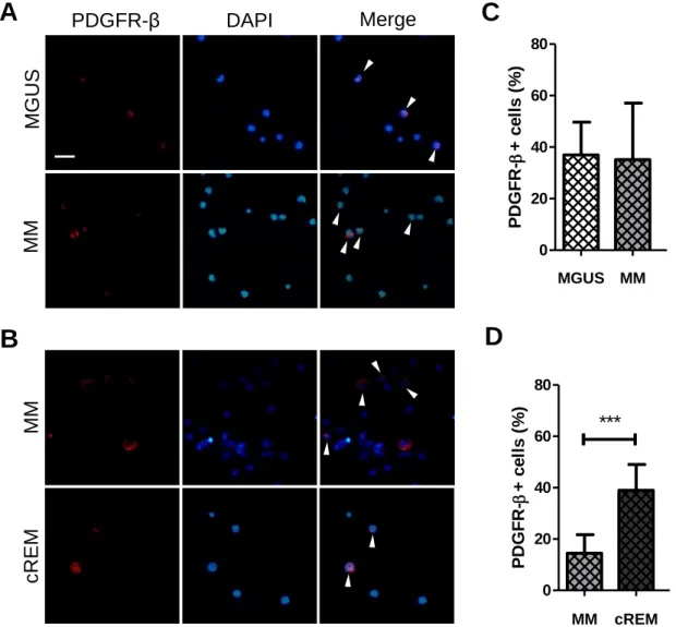 Figure 10: Bone marrow (BM) platelet-derived growth factor receptor (PDGFR)-β +  cells  from monoclonal gammopathy of undetermined significance (MGUS), multiple myeloma  (MM) and complete remission (cREM) patients