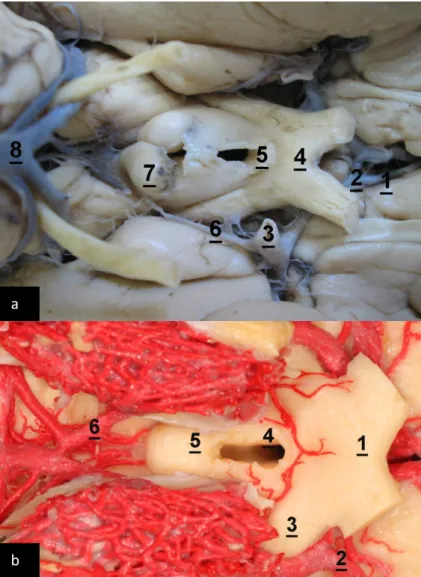 Figura  5  –“A”  Encéfalo  humano,  visão  basal  -  detalhes  das  estruturas  mesencéfallicas