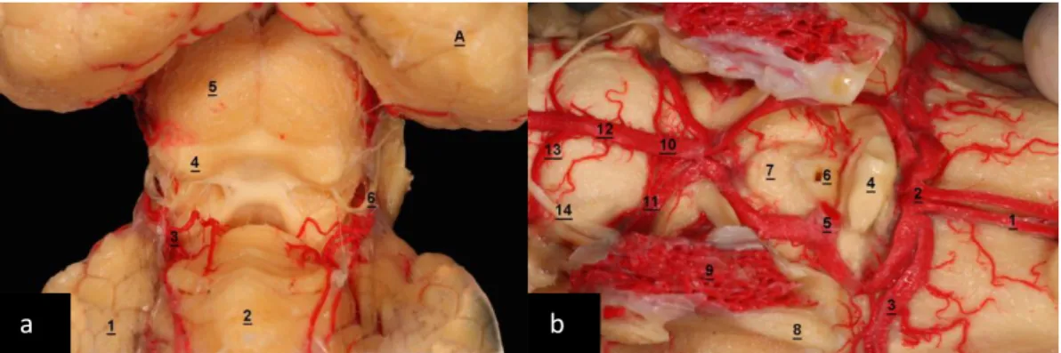 Figura  6  –  “A”  Tronco  encefálico  do  ovino,  visão  superior.  “B”  -  Encéfalo  de  ovino,  visão  basal,   estruturas mesencefálicas e vasculares