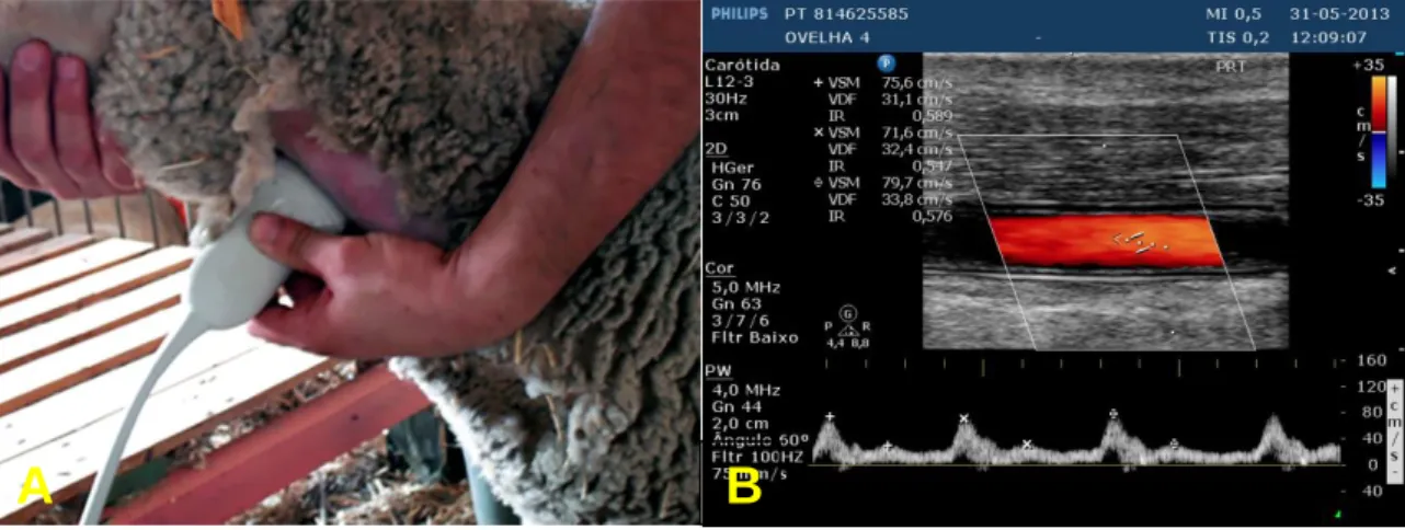 Figura  7 –  (A)  Monitorização  funcional  da  prótese  vascular  de  PVA/Dx em  ovelha,  (B) aspecto de ecografia modo Doppler da prótese de PVA/Dx implantada na artéria  carótida comum