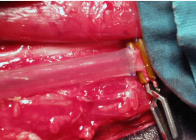 Figura  4 –  Anastomose término-terminal entre a artéria carótida comum e prótese  de PVA/Dx