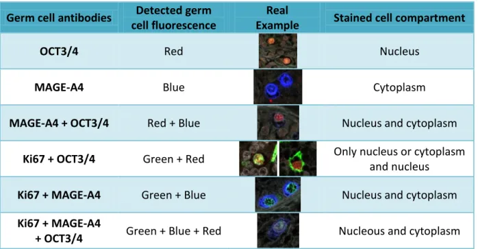 Table  II.  List  of  all  the  staining  combinations  counted  after  scanning  fetal  human  testis immunofluorescently  for  three  different  antibodies  (OCT3/4,  MAGE-A4,  Ki67)