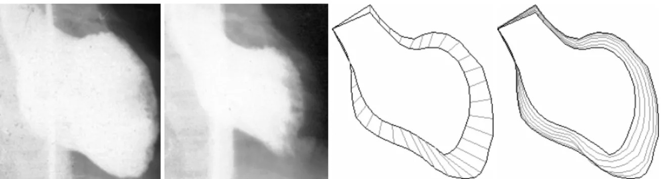 Fig. 1: Imagens reais de um coração em diástole (primeira imagem) e em sístole (segunda imagem)