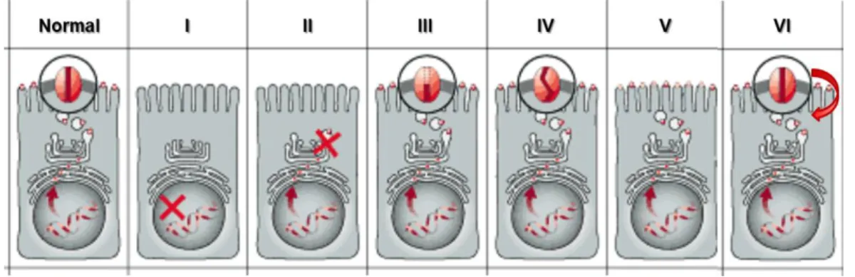 Figure  1.2  –  Classes  of  CFTR  mutations.  (Normal)  CFTR  protein  in  the  plasma  membrane of cells functioning  as a  Cl- channel; (I) class I mutation:  prevent translation; 
