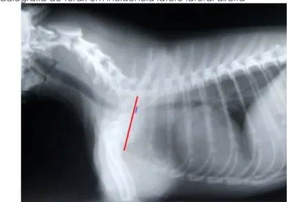 Figura 1 – Radiografia de tórax em incidência látero lateral direita