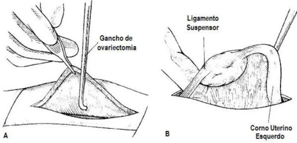 Figura 5 -  A: elevar a parede abdominal com uma pinça de Cushing sem dentes e, com a  ajuda do gancho de ovariectomia, procurar o corno uterino; B: exteriorizar o corno uterino e  identificar o ligamento suspensor do ovário (adaptado de Fossum, 2008)