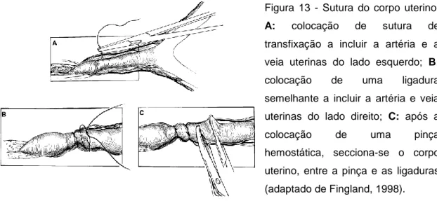 Figura  13  -  Sutura  do  corpo  uterino. 