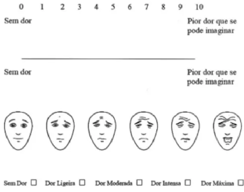 Figura 9 – Escalas de uso comum na avaliação unidimensional da intensidade da  dor: Numerical Rating Scale, Visual Analog Scale, Faces Pain Scale - Revised e 