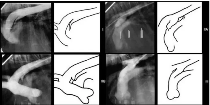 Figura 6 - Angiografia  e  representação  esquemática  de  PCA  em  cão,  com  classificação  de  acordo com a sua morfologia (adaptado de M