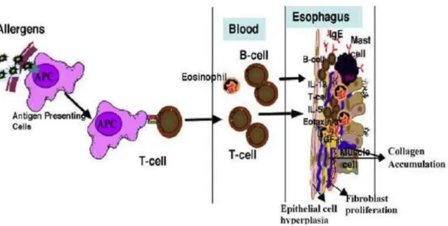 Figura 1. Patogénese sugerida da EoE  [3] . Os alergénios são fagocitados pelas células apresentadoras de  antigénios (APC’s), sendo, posteriormente, apresentados a uma célula T, que induz uma resposta mediada  por  IgE  e  por  células  Th2