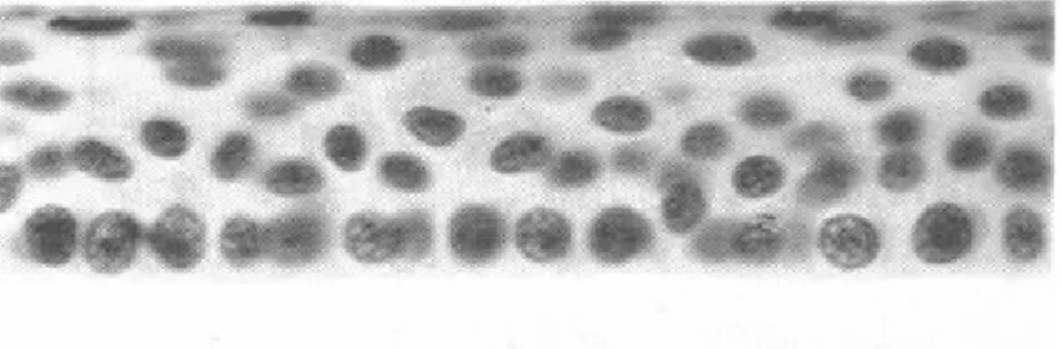 Figura 4. Microfotografia do epitélio corneano. Adaptado de: Junqueira, L.C.,  Carneiro, J