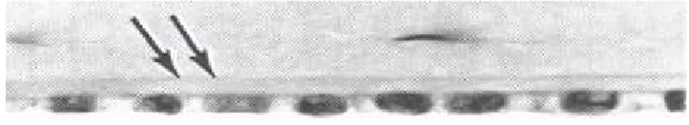 Figura  5.  Microfotografia  da  porção  posterior  da  córnea.  As  setas  indicam  a  membrana  de  Descemet